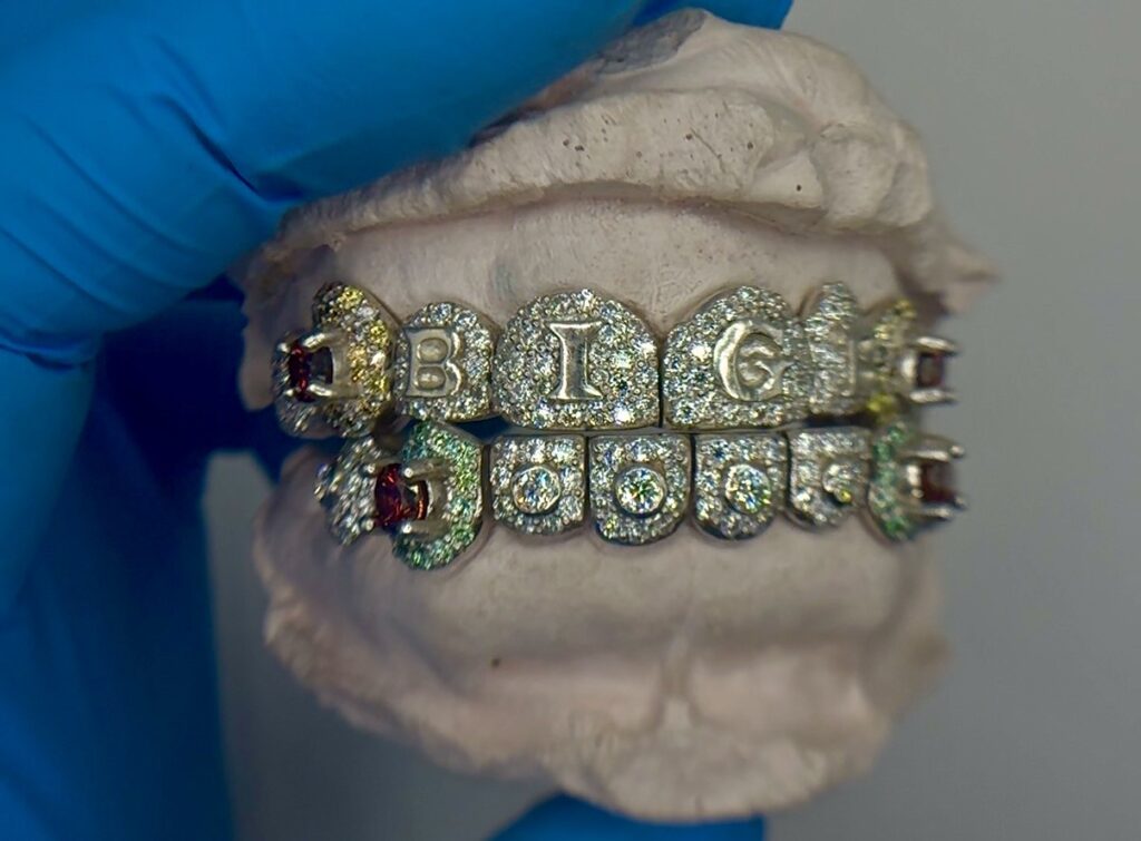 Custom Grillz Consultation