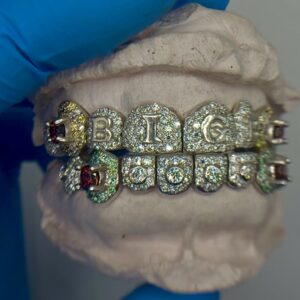 Custom Grillz Consultation